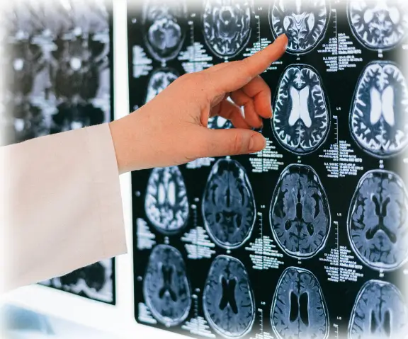 Image of a medical professional looking at brain scans to identify neuroplasticity.